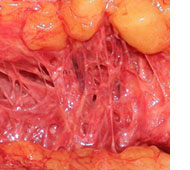 Boston BioLife Online Academy: Regenerative Medicine Overview