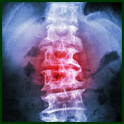 Hands–On Stem Cell Therapies and Biologics for the Clinical Application of Pain Management